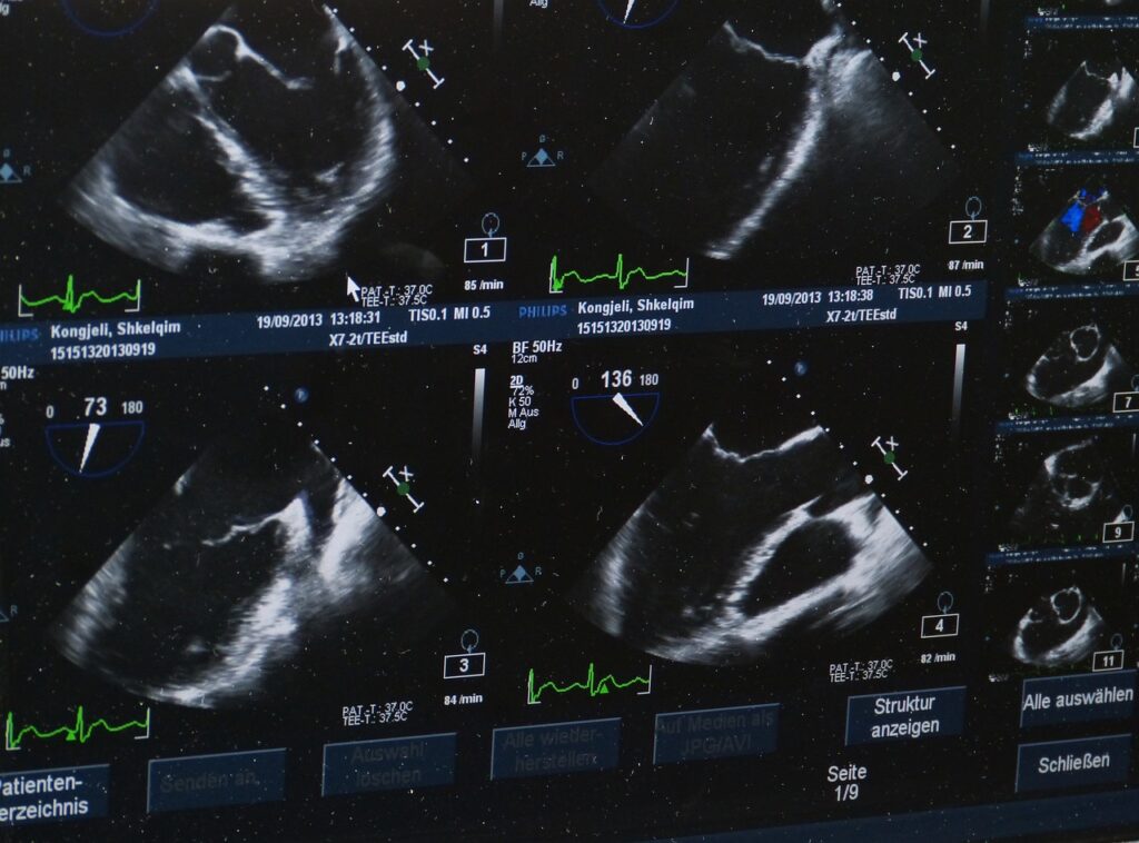 Rewolucja w Diagnostyce: Jak Aparaty USG Siemens Zmieniają Opiekę Zdrowotną